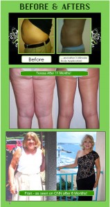 before--after