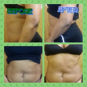BF & AFTR