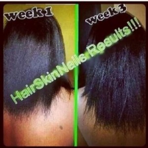 hairgrowth2