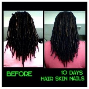 hairgrowth3
